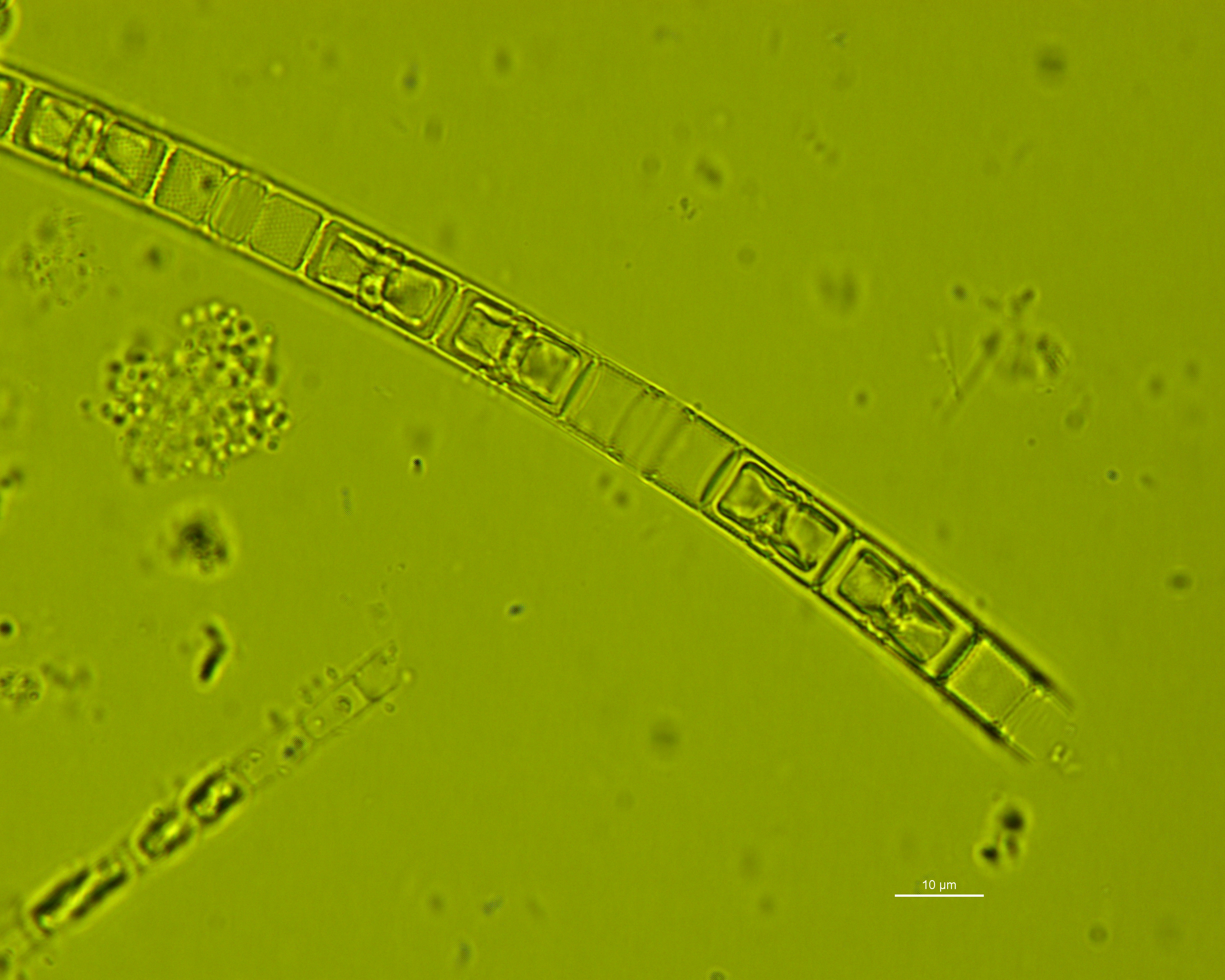 Dictyocha speculum